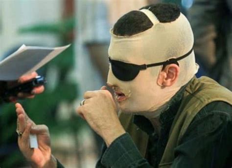 Iranian Acid Attacker Who Blinded Man Has Eye Gouged Out As Punishment
