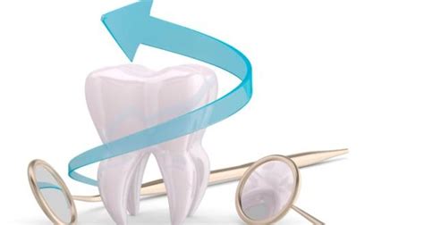 10 Ways You Can Prevent Dental Cavities Read Health Related Blogs Articles And News On Oral