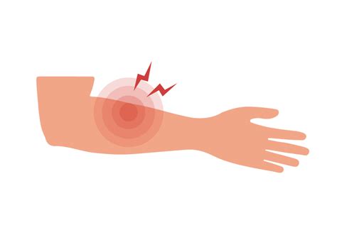 Right And Left Sided Forearm Pain Causes And Treatments Buoy