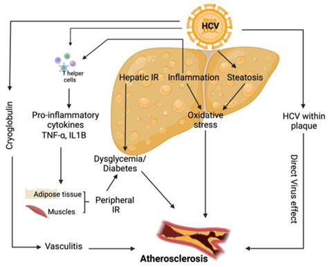 Biomedicines Free Full Text Hepatitis C Virus Lipid Interplay