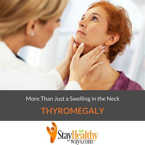 Thyromegaly More Than Just A Swelling In The Neck Stay Healthy Ways
