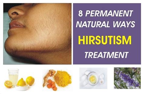 Hersute For Hirsutism Unwanted Hair Growth In Women Thuja 40 Off