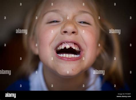 Tooth Loose Hi Res Stock Photography And Images Alamy