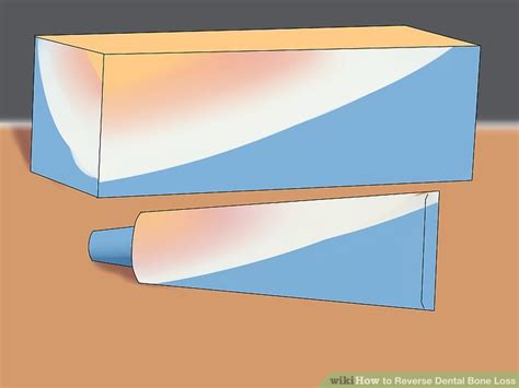 Plaque contains bacteria that can irritate and inflame. 3 Ways to Reverse Dental Bone Loss - wikiHow