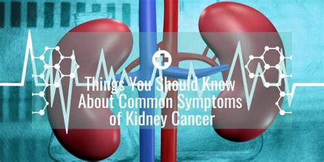 Things You Should Know About Common Symptoms Of Kidney Cancer Dubai