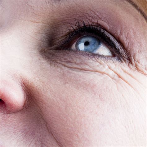 5 Types Of Wrinkles And How To Tackle Each One Newbeauty