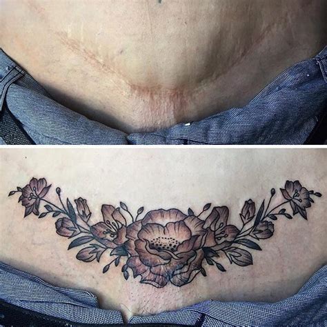 Il tatuaggio floreale che ti fa amare te stessa come non hai maifatto prima. Tatuaggi cicatrici: 215 esempi di tatuaggi per coprire ...