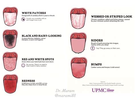 Maram Alhati On Twitter What Does Your Tongue Say About Your Health