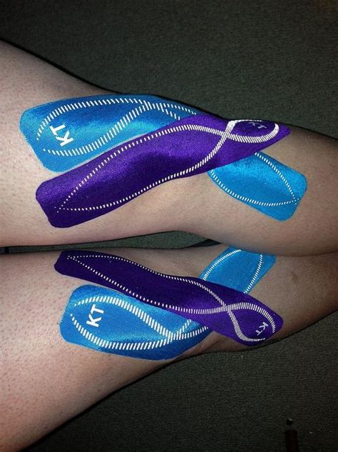 Kt tape europe outer knee taping. KT Tape Pro for chondromalacia | Kinesiology taping ...