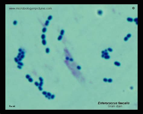 Enterococcus Faecalis Micrograph Gram Stain Enterococci Under