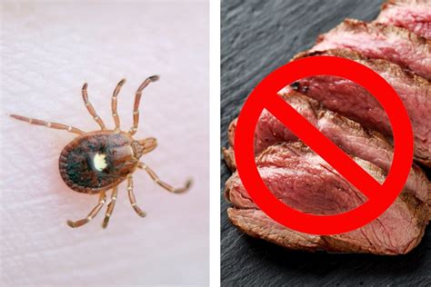 Alpha Gal Syndrome How Ticks Can Make You Allergic To Red Meat