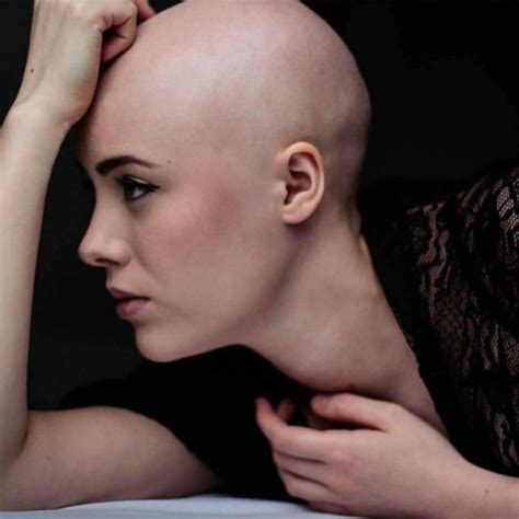 Love Bald Women Bald Women Hair Cuts Balding