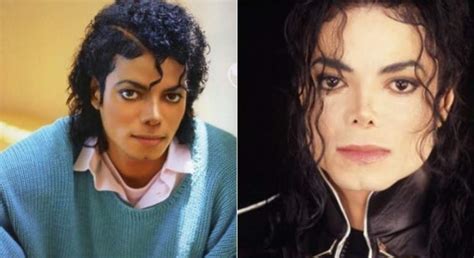 Michael Jackson Y Su Obsesión Por Operarse De La Nariz