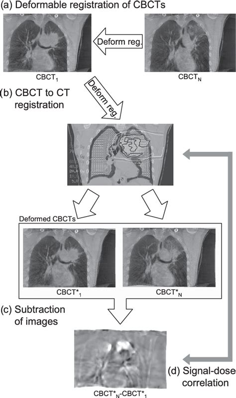 Figure 1 From Radiation Dose Response Of Normal Lung Assessed By Cone