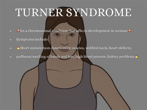 Genetic Disorders That Cause Short Stature