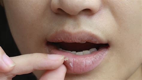 Heres What May Be Causing Your Chapped Lips