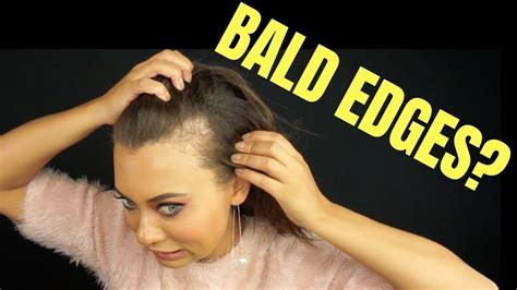 25 Hairstyles That Hide Bald Spots Hairstyle Catalog