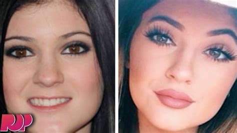 kylie jenner admits to getting lip implants youtube