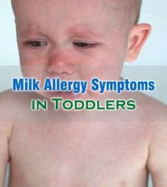 With a milk allergy in infants, a baby's immune system reacts negatively to the proteins in cow's milk. Pin by Deepika Kumar on eHealthyBlog.com | Allergy ...