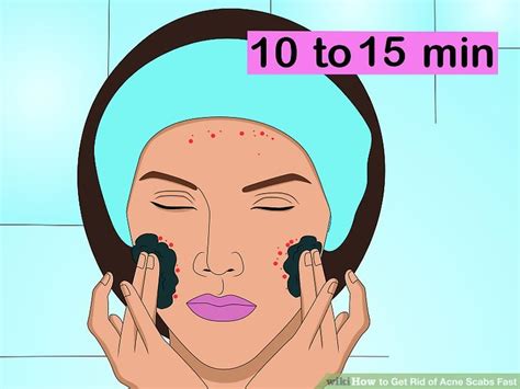 If sunburn causes blisters, cover it with sterilized gauze for protection and promoting moist environment, which is essential for proper healing. 4 Ways to Get Rid of Acne Scabs Fast - wikiHow
