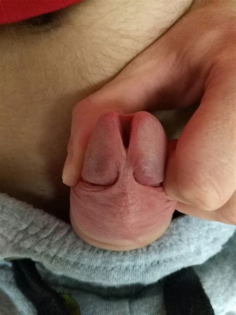 Tumbex Genital Mod Genital Modification Male Genital Mod