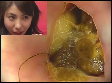 Pictures Showing For Anal Camera Mypornarchive Net