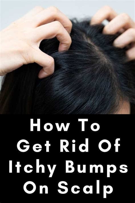 What Causes Itchy Bumps On Scalp And How You Can Get Rid Of Them In