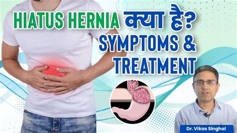 What Is Hiatus Hernia Hiatus Hernia क्या है Symptoms And Treatment