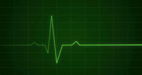 Concept Animation Of An Ecg Or Ekg Heartbeat Cardiogram On A Green