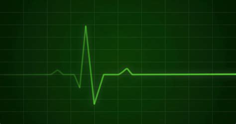 Concept Animation Of Ecg Ekg Heartbeat Stock Motion Graphics SBV Storyblocks