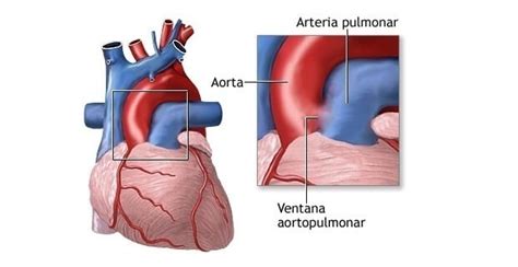 Arteria Pulmonar Origen Trayecto Función Desarrollo Importancia