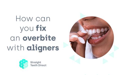For mild underbites, you can get braces, tooth extractions, or an upper jaw expander. Overbite: wondering if clear aligners could fix yours?