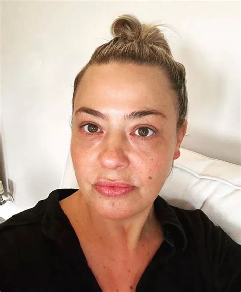 Ant Mcpartlins Ex Lisa Armstrong Breaks Silence After £5m Mansion Goes Up In Flames Ok Magazine