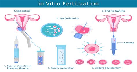 Ivf Procedure Step By Step Ivf Process Start To Finish