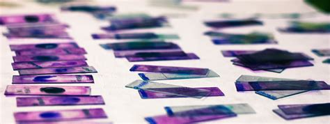 Stained Glass Slides Of Peripheral Blood Smear With Violet Leishman