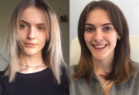 Thick Hair Thinned Out Hair Before And After Pictures Before And After