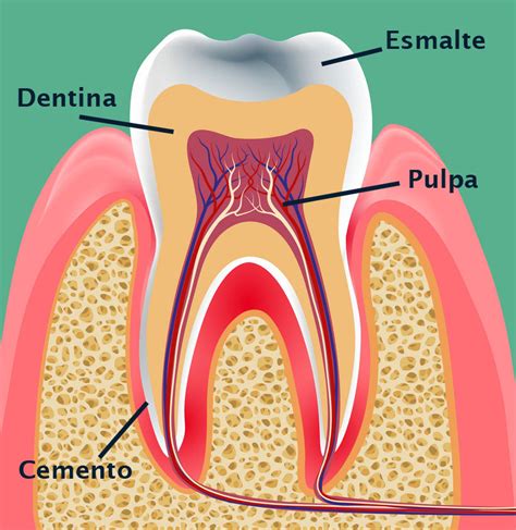 La Pulpitis Dental Causas Y Tratamiento