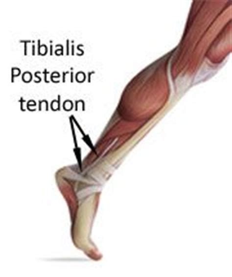 Achilles tendon pain is very difficult to handle, especially without the proper skills and information. Pin on Running Recovery