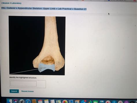 Solved Pb Appendicular Skeleton Upper Limb Lab Practical