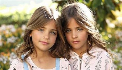 these twins were named “most beautiful in the world ” wait till you see them today