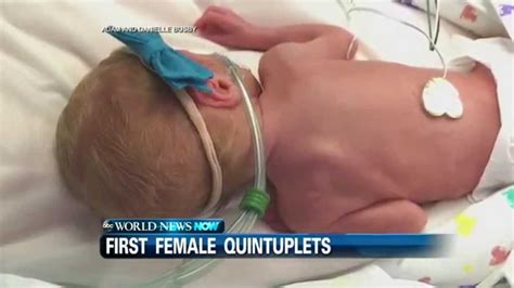First Female Quintuplets In Us Born To Houston Couple Youtube