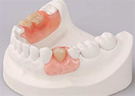 Proteze Dentare Mobile Moderne Dental Premier