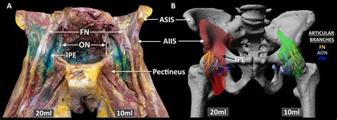 Is pericapsular nerve group (PENG) block a true pericapsular block
