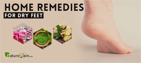 8 Superb Home Remedies For Dry Feet To Heal Cracked Heels Naturally