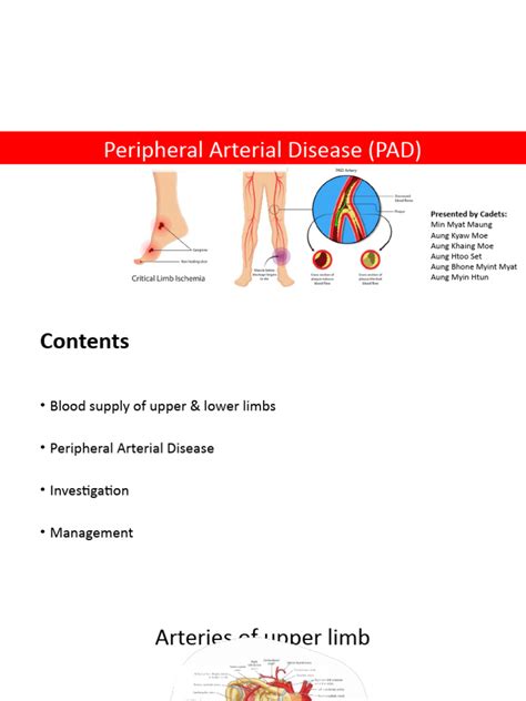Peripheral Arterial Disease Seminar Pdf Ischemia Embolism