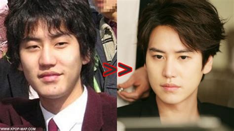 10 Shocking Korean Idol Plastic Surgery Transformations Kpopmap
