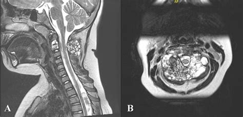 Rose Radiology Open Mri Abdominal Imaging Emergency Imaging Nuclear