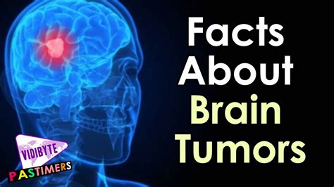 Top Ten Facts About Brain Tumors Health Facts Youtube