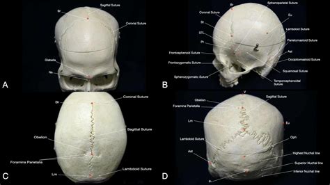 Cureus Immersive Surgical Anatomy Of The Craniometric Points