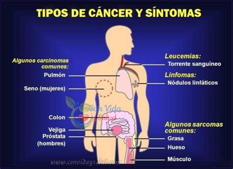 Tipos De Cáncer Y Sintomas Con Vida Y Salud